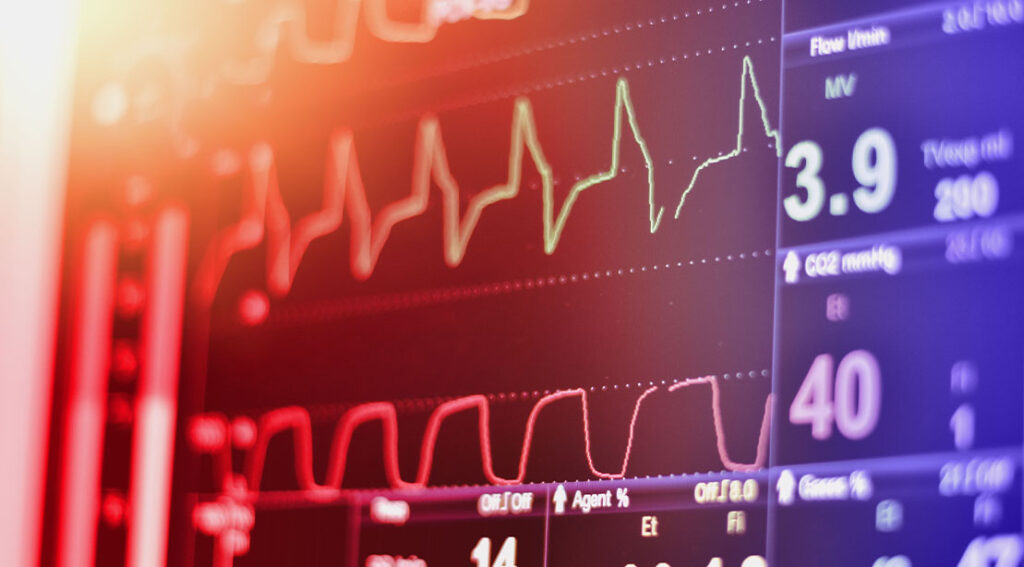 Understanding Heart Rate Variability (HRV) and How To Use It