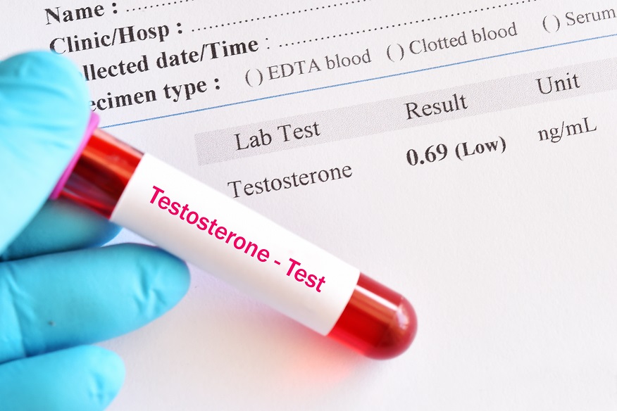 Abnormal low testosterone hormone test result