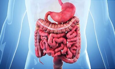 Prospects for Crohn's Relief Brighten With New Advancements