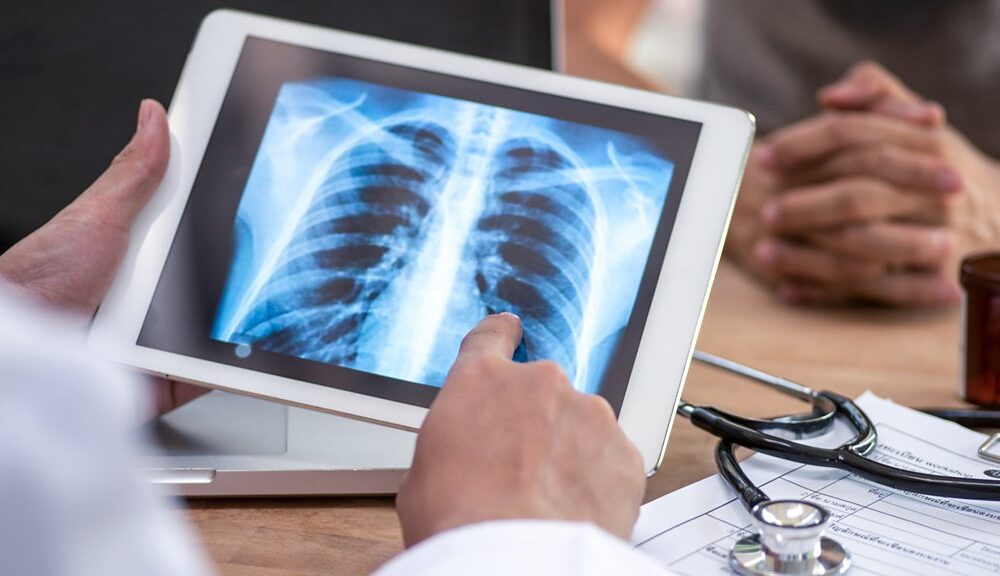 Tech Life: AI helps doctors detect lung cancer