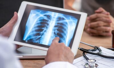 Tech Life: AI helps doctors detect lung cancer