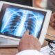 Tech Life: AI helps doctors detect lung cancer