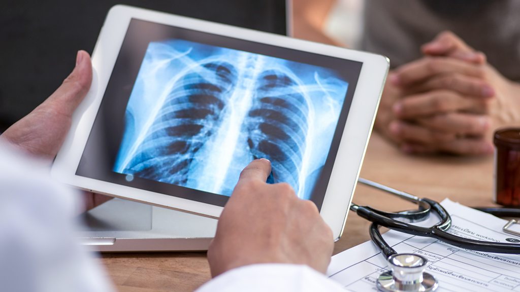 Tech Life: AI helps doctors detect lung cancer