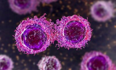 Study: NSD2 is a requisite subunit of the AR/FOXA1 neo-enhanceosome in promoting prostate tumorigenesis. Image Credit: Kateryna Kon/Shutterstock.com