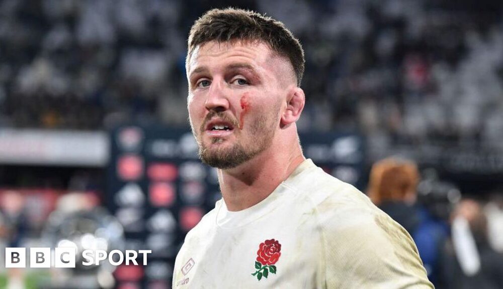 Tom Curry: England flanker on hip surgery and news career could be over